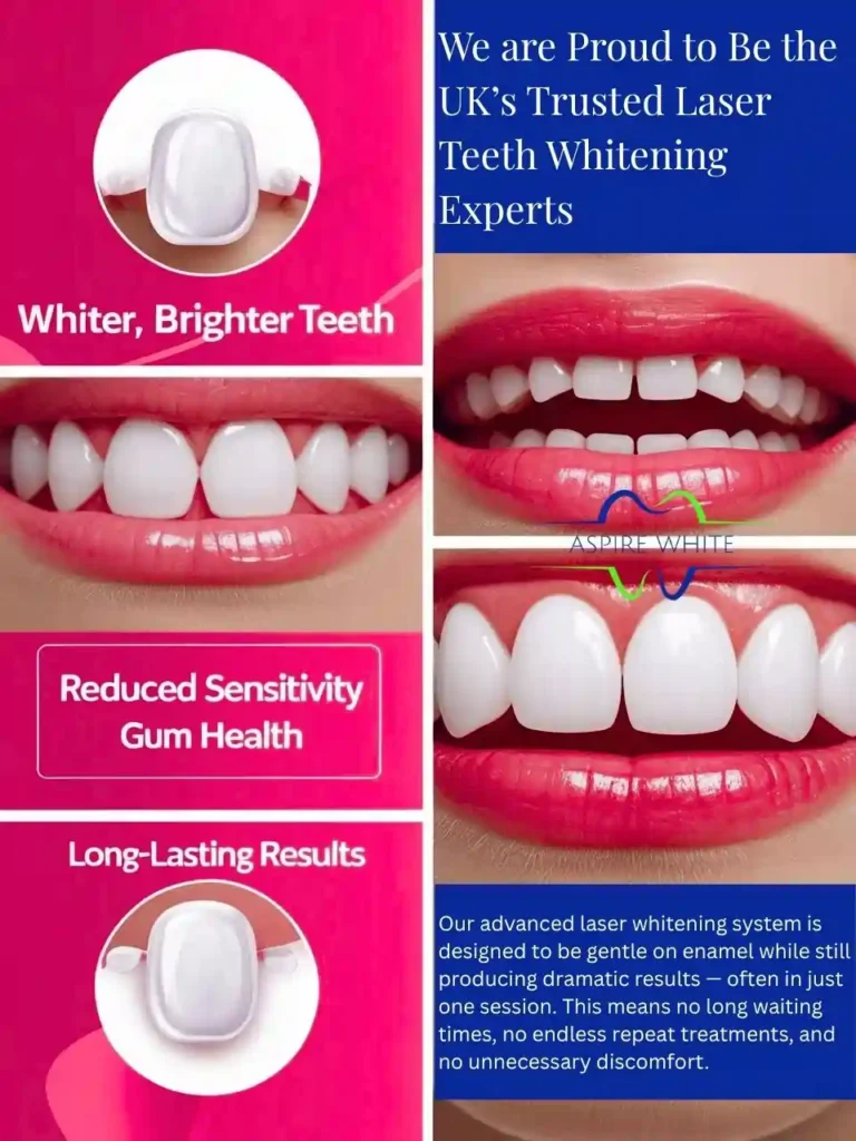 We are Proud to Be the UK’s Trusted Laser Teeth Whitening Experts Aylesbury