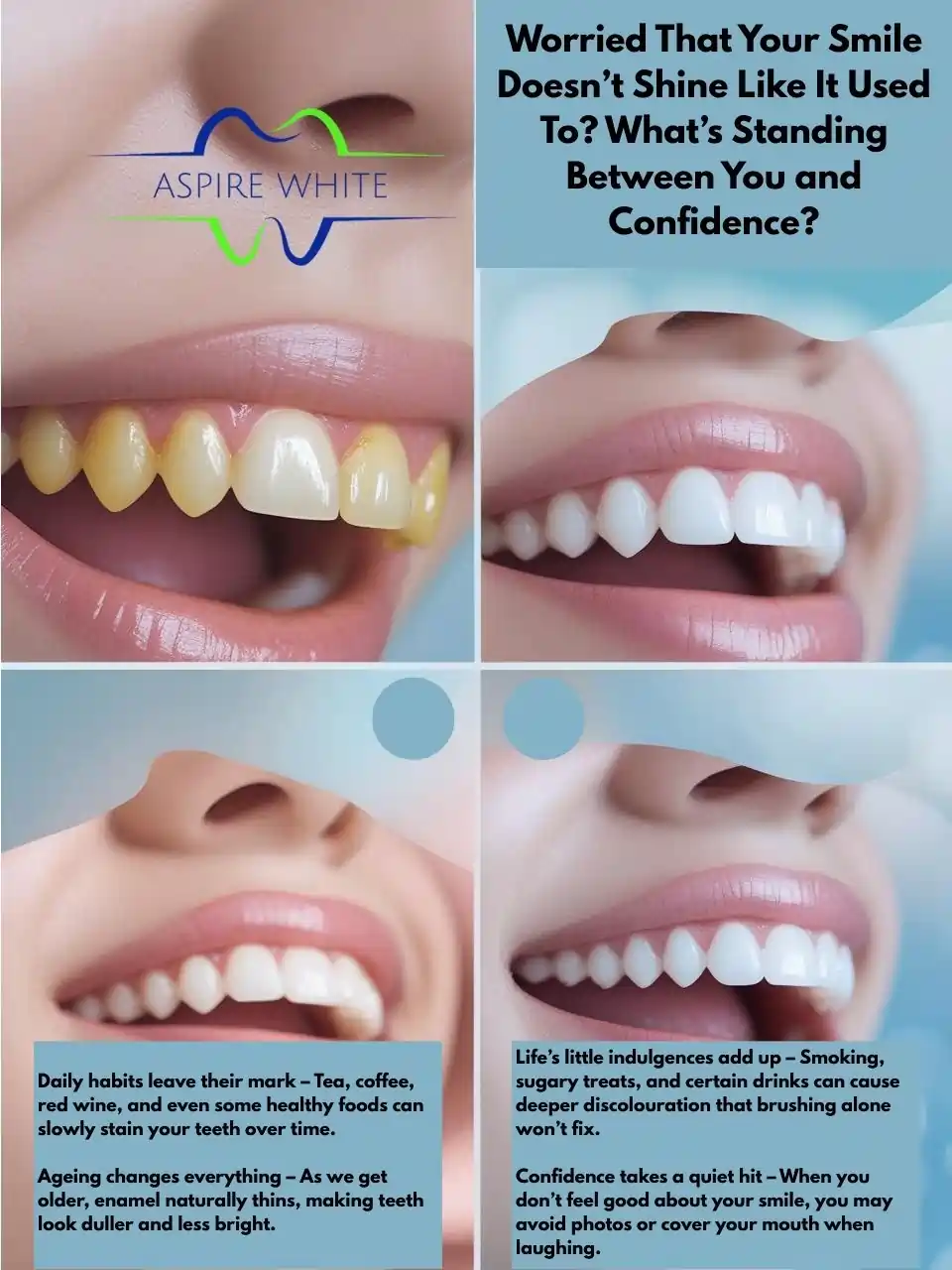 Worried That Your Smile Doesn’t Shine Like It Used To What’s Standing Between You and Confidence Aylesbury